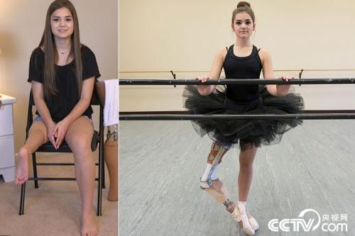 Cancer survivor ballerina dances again